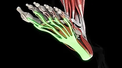 Is it just plantar fasciitis? Diverse causes of foot pain... Foot care methods for walking