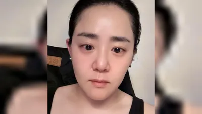 Moon Geun-young shares update after marrying Jeongpyeong... "Taking care of my skin"