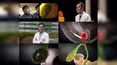 EBS Myeong-ui Highlights the Dangers and Treatments of Gallbladder and Bile Duct Diseases