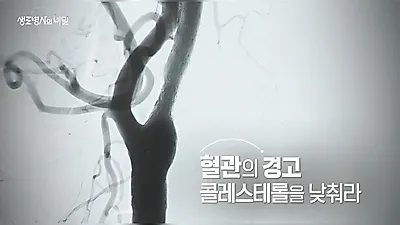 KBS Mysteries of the Human Body, September 30 at 10 PM: Even with LDL at 130, Treatment Standards Differ