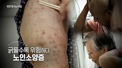 KBS program to explore causes and new treatments for geriatric pruritus
